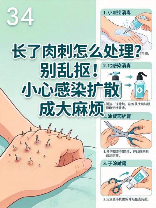 长了肉刺怎么处理？别乱抠！小心感染扩散成大麻烦