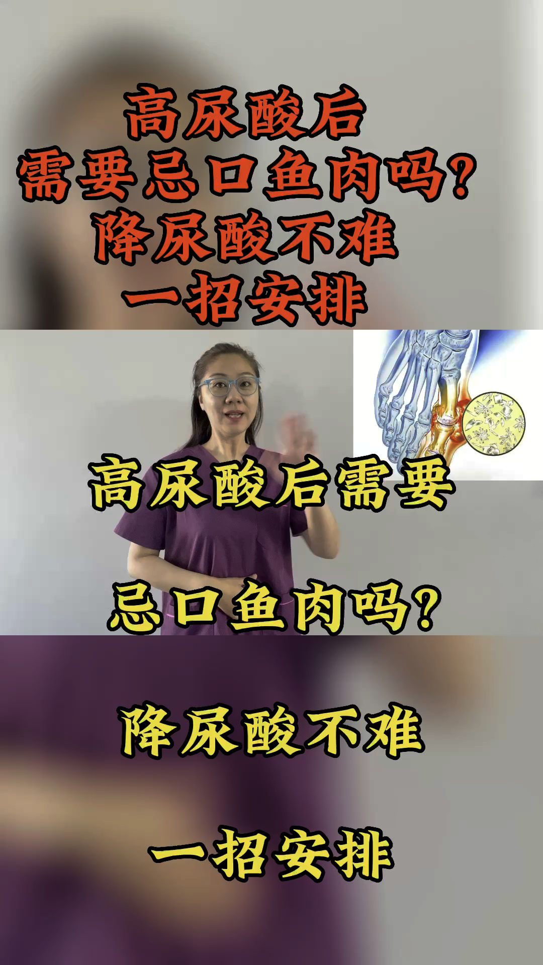 高尿酸后需要忌口鱼肉吗?降尿酸不难,一招安排