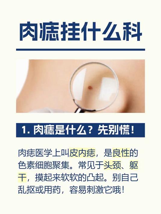 肉痣挂什么科