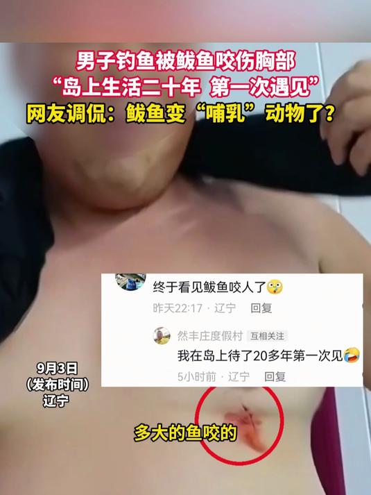 男子钓上鲅鱼后被鱼反咬一口