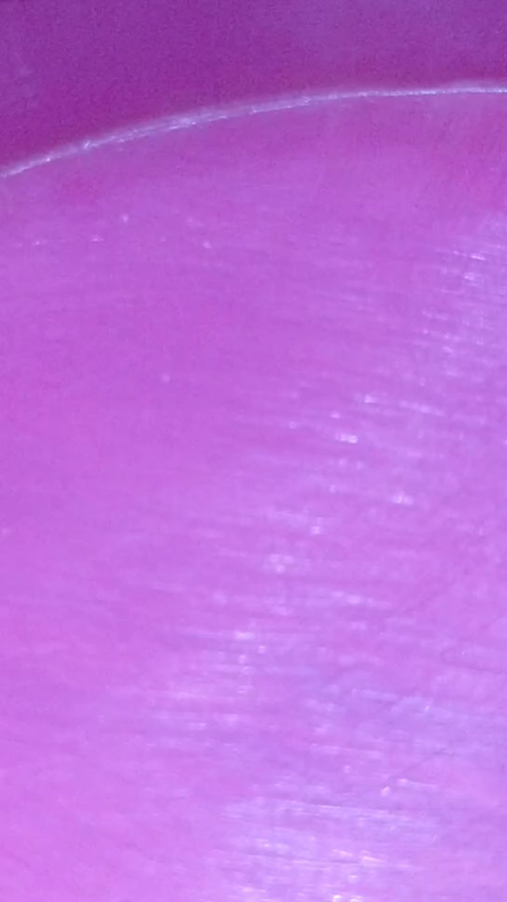瓶盖上长着这种是什么虫子,对人有危害吗?