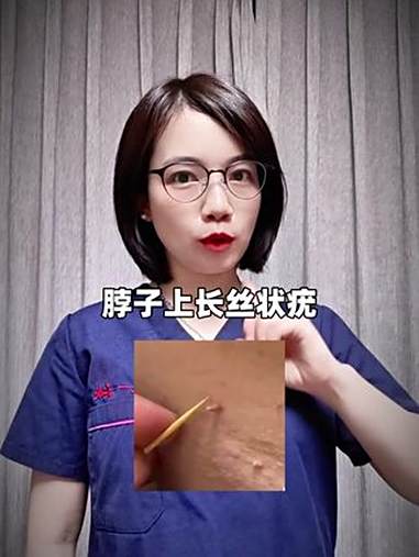 HPV是什么病毒 hpv 丝状疣 跖疣 扁平疣