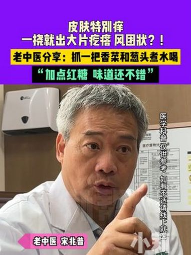 皮肤特别痒,一挠就出大片疙瘩,风团状?!老中医分享:香菜和葱头抓一把,煮水喝