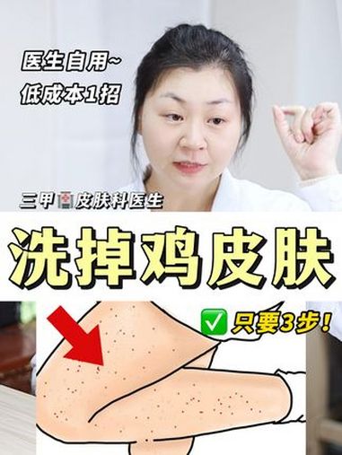 手臂、大腿这些麻麻赖赖,医生教你处理!鸡皮肤 毛周角化 变美小技巧 护肤分享 抖出健康知识