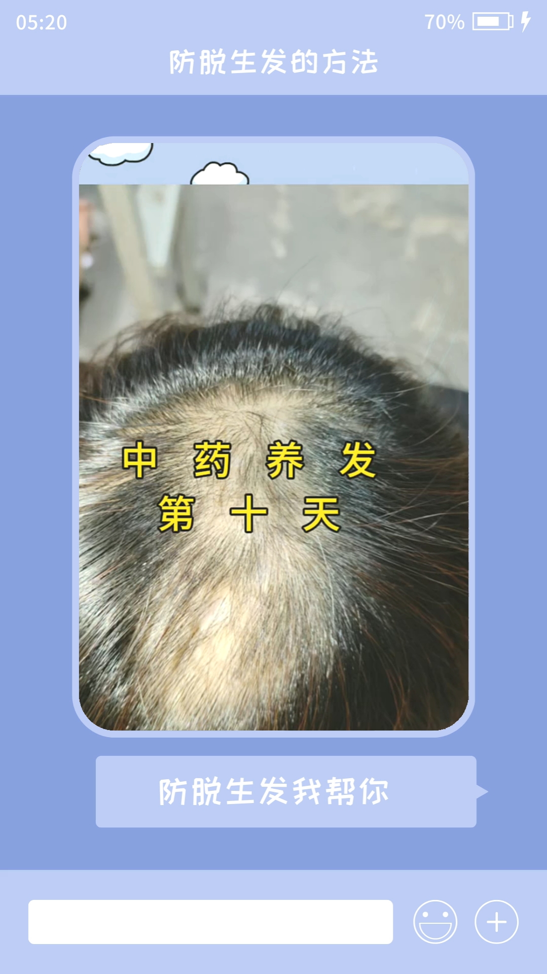 养发护发的方法,什么方法能够防脱生发?