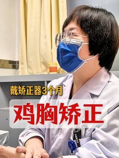 女孩鸡胸戴矫正器三个月,明显改善但还需持之以恒。鸡胸 健康科普 医学科普 门诊日常 抖出健