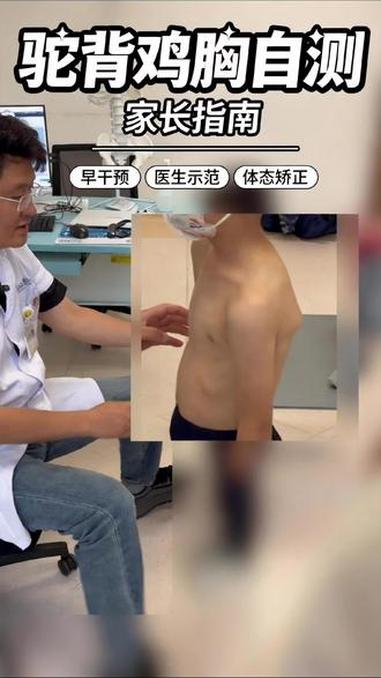 居家自测孩子胸壁到底有没有问题 #健康科普破圈计划 #抖出健康知识宝藏 #鸡胸 #漏斗胸 