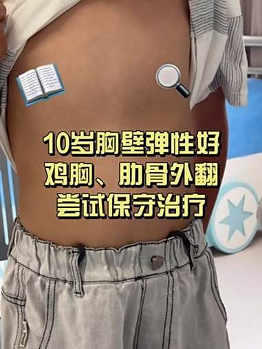 10 岁鸡胸、肋骨外翻的保守治疗 鸡胸 肋骨外翻 漏斗胸 儿童胸外科李飞 抖出健康知识宝藏