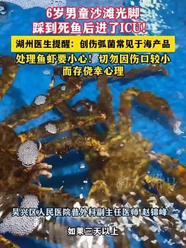 6岁男童沙滩光脚踩到死鱼后进了ICU!湖州医生提醒:创伤弧菌常见于海产品(视频:吴明宪 徐