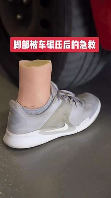如果你的脚被车碾过，急救 一只脚被踩翻了吗？以下是帮助的方法——循序渐进的急救：1脱下鞋子