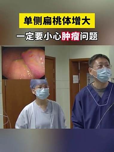 扁桃体肥大 单侧扁桃体肿大 倪晓光 健康科普有真知
