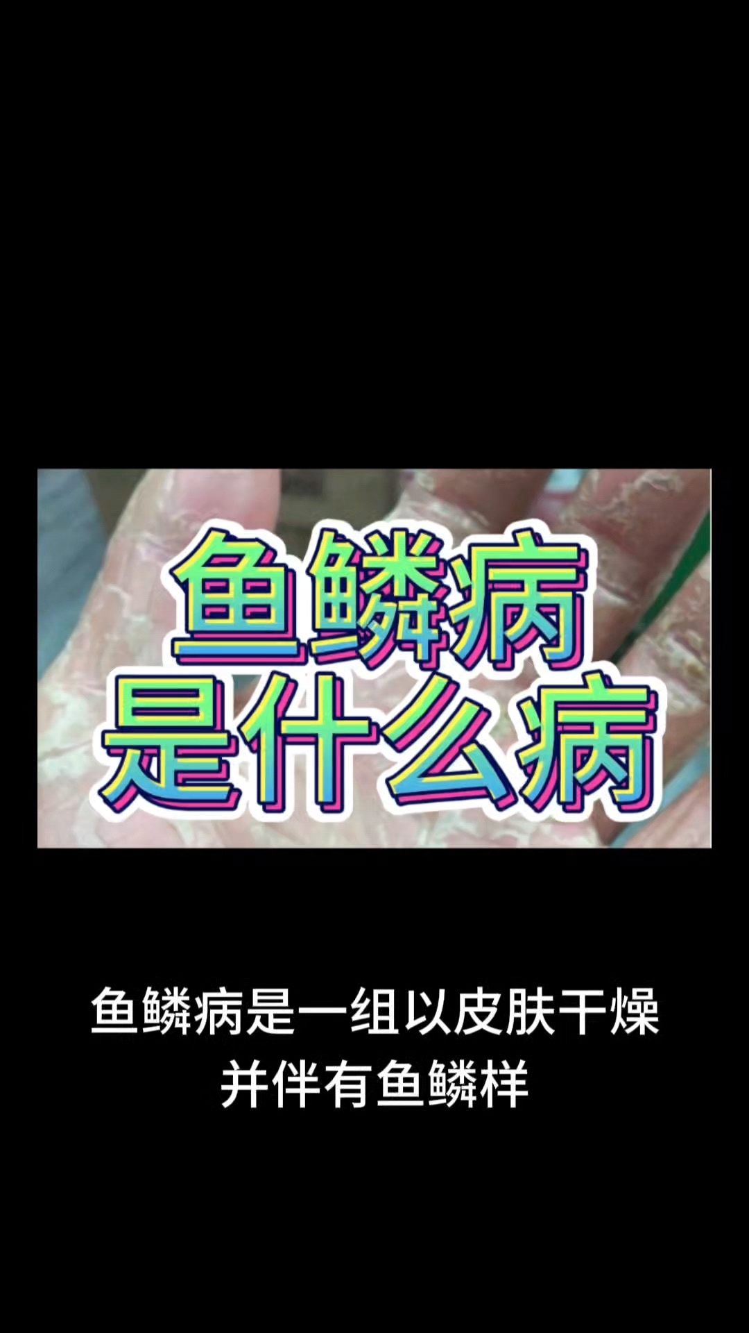 鱼鳞病是什么病 #领航计划#