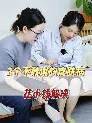 有个医生老姐也太爽了,一杯奶茶钱就搞定我的皮肤问题了 腋下黑 鱼鳞病 鸡皮肤 肥胖纹 抖出