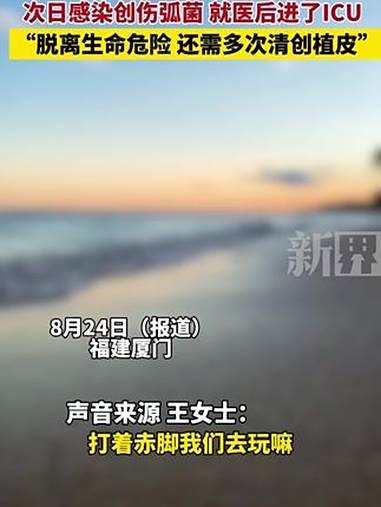 6岁男孩光脚在沙滩上踩到死鱼，次日感染创伤弧菌 就医后进了ICU，“脱离生命危险 还需多次