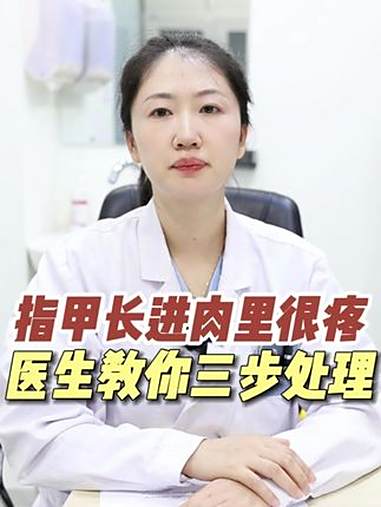 指甲钻进肉里又红又肿,别乱剪了,这是甲沟炎,医生教你处理。甲沟炎 嵌甲 红肿 硬核健康科普