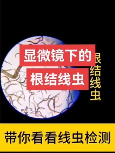 根结线虫长什么样 服务三农支持三农 病虫害防治 咔线 根结线虫