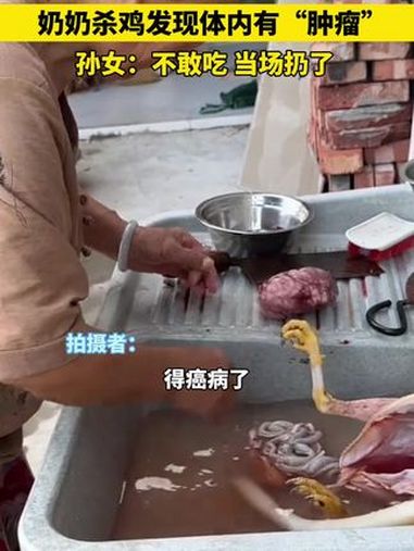 奶奶杀鸡发现体内有“肿瘤”