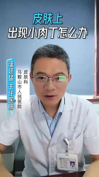 皮肤上长瘊子怎么办?皮肤上长瘊子怎么办?寻常疣 刺猴 HPV 瘊子 痦子 @人民日报