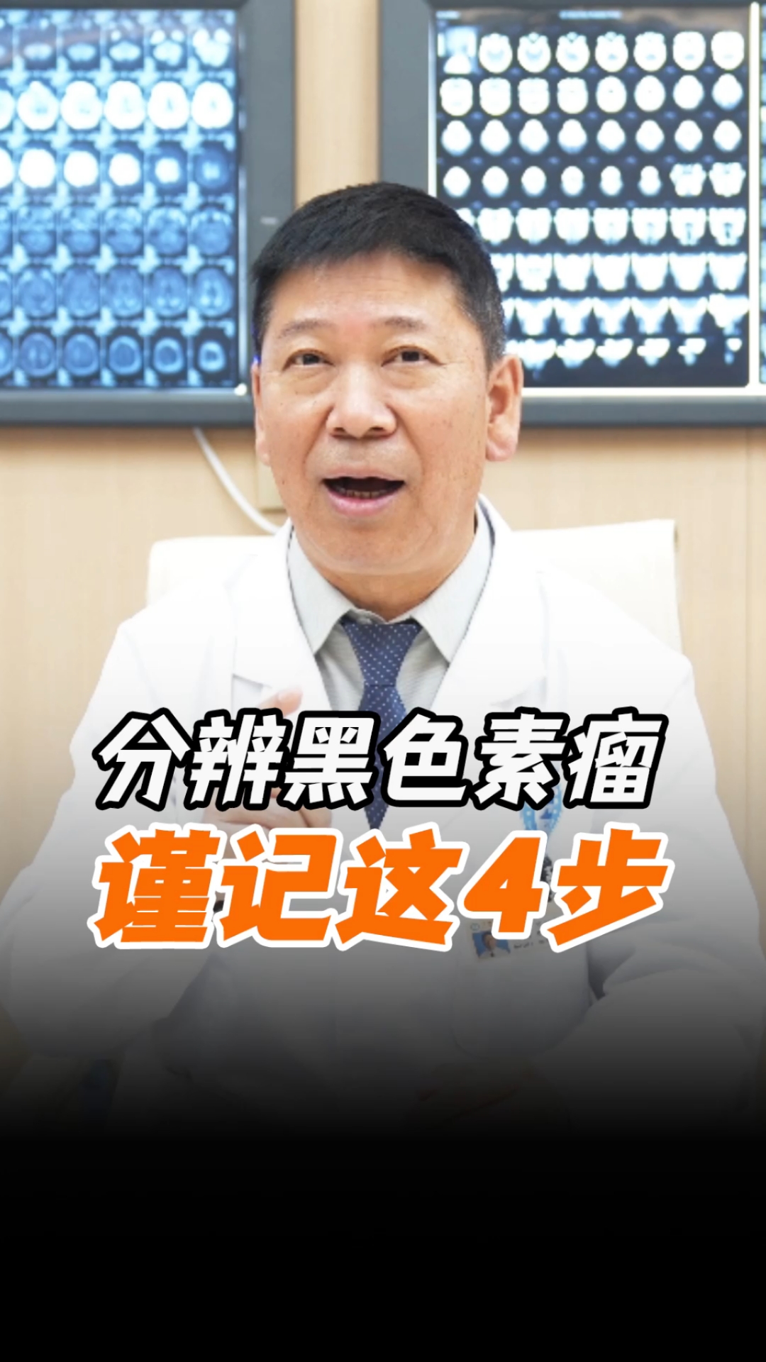 黑色素瘤跟痣还傻傻分不清?速看这4招!