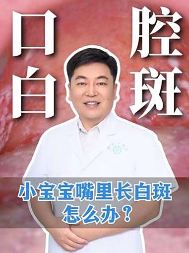 小宝宝嘴里长白斑，该怎么办？鹅口疮 常见病科普 新生儿 新手爸妈 抖出健康知识宝藏