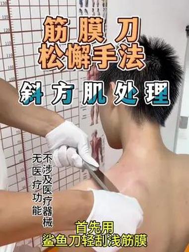 筋膜刀松懈手法,斜方肌处理 筋膜刀 斜方肌 筋膜刀的作用和功效 体态调整