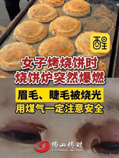 女子烤烧饼时烧饼炉突然爆燃,眉毛、睫毛被烧光,用煤气一定注意安全。(编辑:黄雅琳;责编:崔