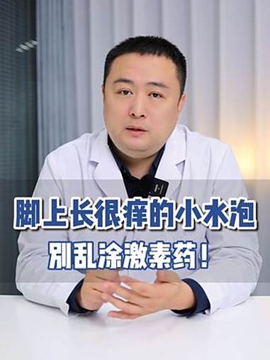 脚趾缝、脚底长小水泡,奇痒无比 这是 水泡型脚气,别再乱涂激素药了,小心越涂越严重!脚气 