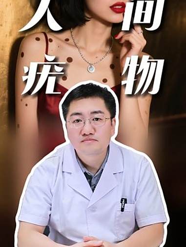 快看看这 7 种疣你见过哪种！疣 抖出健康科普知识宝藏 涨知识 男生女生必看 @抖音创作小