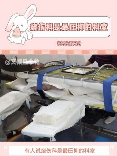 烧伤科是最压抑的科室 烧伤 重度烧伤 安全第一 医院
