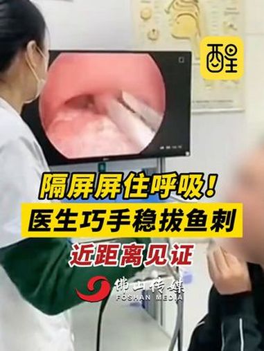 隔屏屏住呼吸!医生巧手稳拔鱼刺,近距离见证。(编辑:梁铭鼎;责编:郭少媚;素材来源:美丽浙