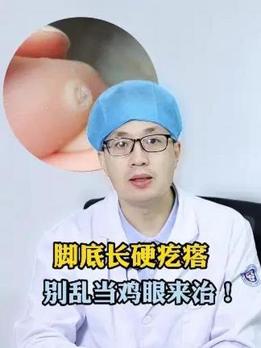 这种粗糙的疙瘩,里面还有小黑点,可不是鸡眼!而是HPV感染引起的跖疣