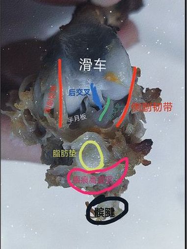 吃鸡腿,学解剖 膝关节