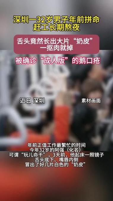 男子起床后吓出一身冷汗!舌头长出大片“奶皮”(新闻坊)