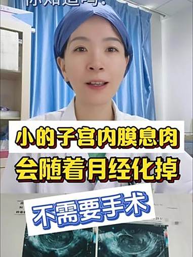 小的子宫内膜息肉会随着月经化掉,不需要手术!小的子宫内膜息肉会随着月经化掉,不需要手术!子