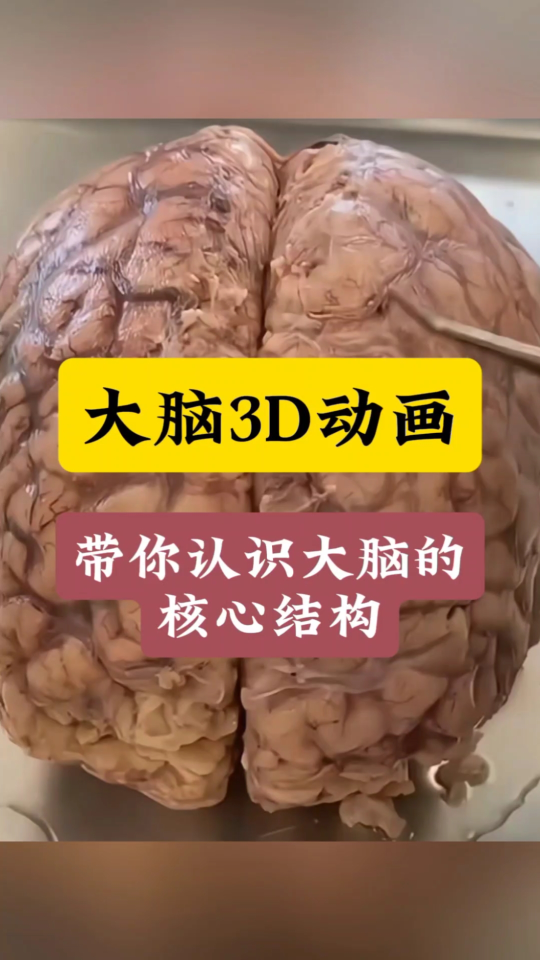 大脑解剖科普:超高清3D动画,带你认识大脑的核心结构