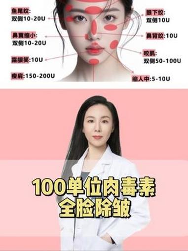 一只肉毒素如何高性价比全脸除皱?每个部位到底需要多少单位?肉毒素 肉毒素除皱 硬核健康科普