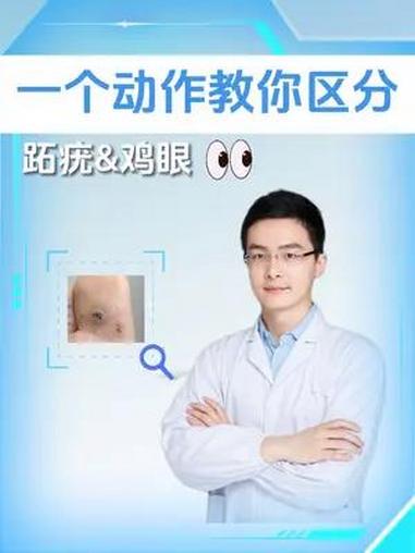 一个动作教你区分 鸡眼 和 跖疣 硬核健康科普行动 医学科普