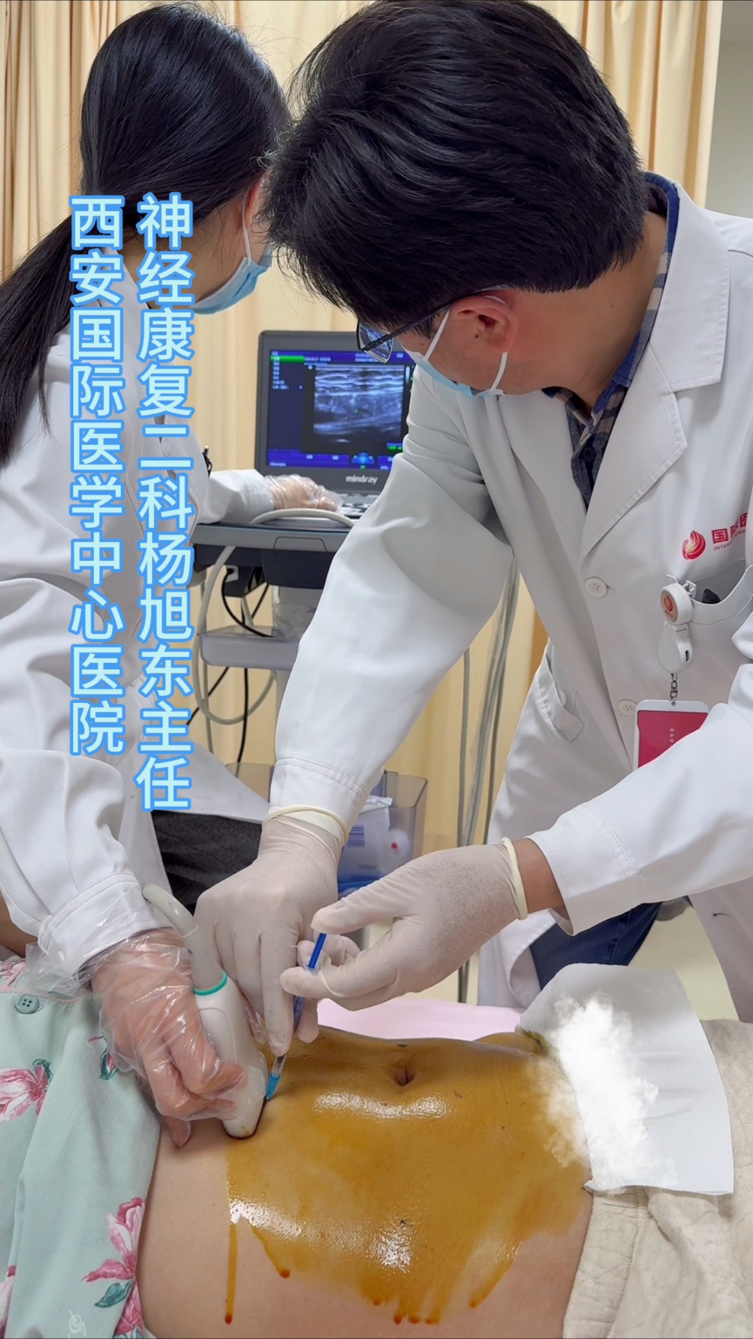 腹部肌肉痉挛导致身体无法挺直,伴严重痉挛疼痛,肉毒素注射治疗