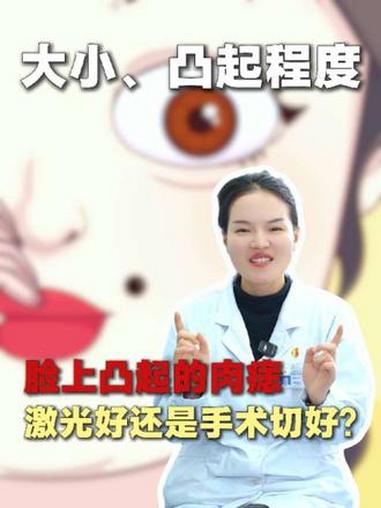 脸上凸起的肉痣，激光好还是手术切好？#健康美容 #医美微整 #肉痣祛除 #激光点痣 #手术