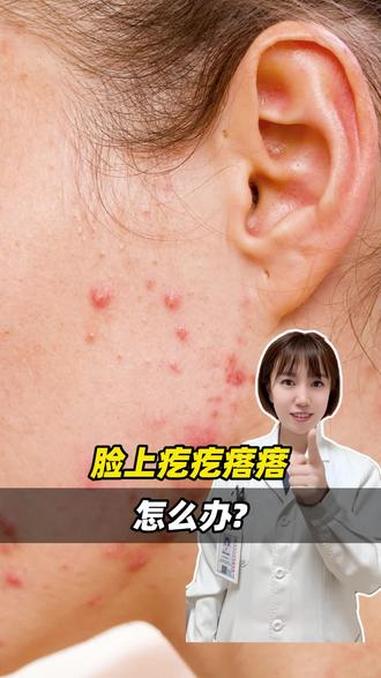 脸上疙疙瘩瘩怎么办#涨知识 #抖出健康知识宝藏 #皮肤健康 #大数据推给有需要的人