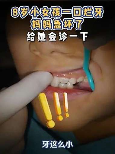 8岁小女孩一口烂牙,妈妈急坏了,给她会诊一下