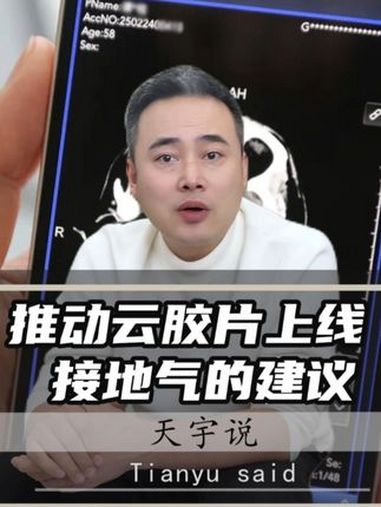推动云胶片上线 接地气的提议 张俊杰:推动医学影像通用互认 天宇说 抖音热评