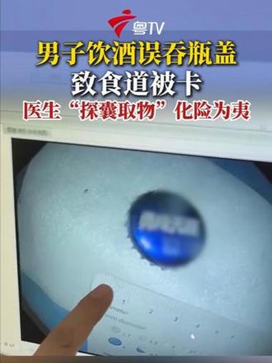 近日，陕西西安一男子吃夜宵时，没注意啤酒瓶盖掉进酒杯，直接仰头一饮而尽，导致瓶盖卡在食道里