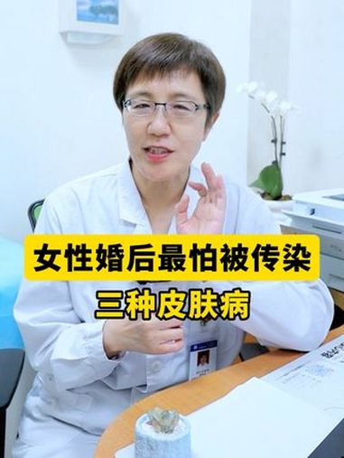 女生结婚后怕被老公传染的三种皮肤病,一条视频教你处理,男女都要看!脚气 股癣 丝状疣 抖出