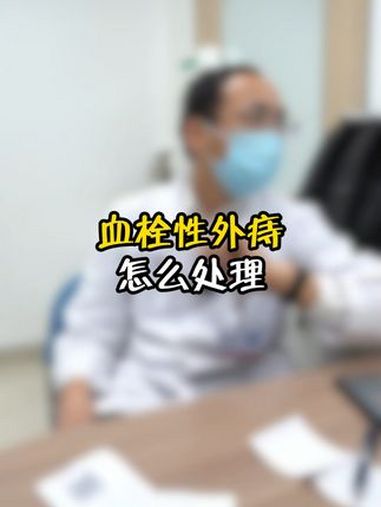 血栓性外痔怎么处理 医学科普 痔疮 血栓性外痔 中医