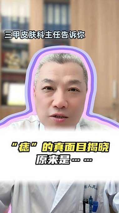 “痣”的真面目揭晓,原来是……不是胎记,不是痣,也不是皮内痣,到底是什么呢?医学科普 皮肤
