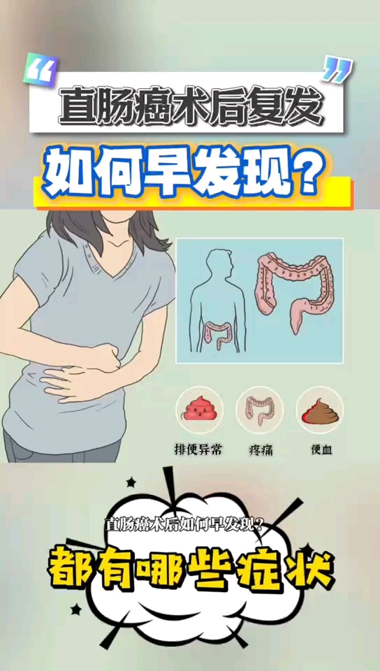 直肠癌复发如何早发现?