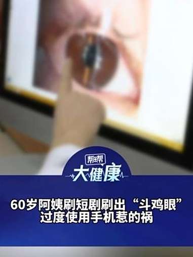 60岁阿姨刷短剧刷出“斗鸡眼” 过度使用手机惹的祸 医生:小心眼部肌肉“卡顿”无法回正 老