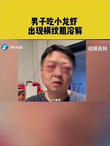男子吃小龙虾 出现横纹肌溶解