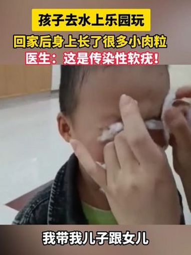 孩子去水上乐园玩身上长很多小肉粒?这是病毒感染!传染性软疣 水上乐园 暑假 医学科普 健康